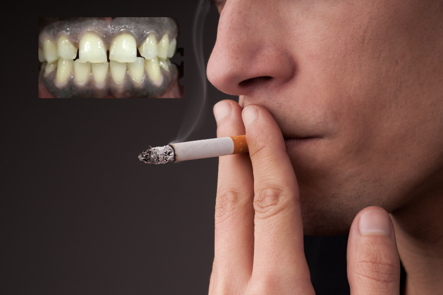 Gum Becomes Black From Smoking